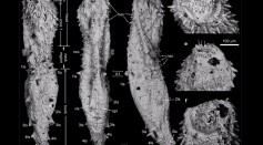 530-Million Year Old Fossils Of Ancient Microscopic Worms Discovered In China