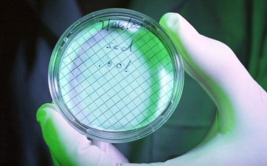 A petri dish holds bacteria, July 26, 2000 that were found in samples of untreated raw sewage runoff known as 'aguas negras' that was taken from a canal in Ciudad Juarez, Mexico