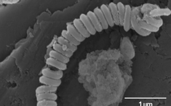 Carbon nanotube under an electron microscope