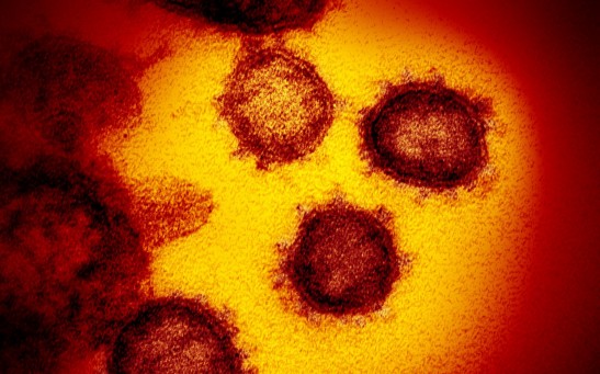Coronavirus Can Survive Prolonged Exposure to High Heat, Says New Experiment