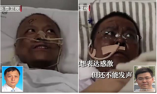 Wuhan Doctors Critically Ill of CoVID-19 Found Their Skin Turn Dark