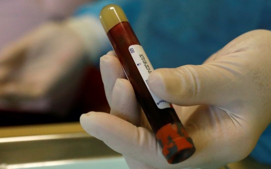 Birmingham University game-changer blood test for asymptomatic coronavirus patients