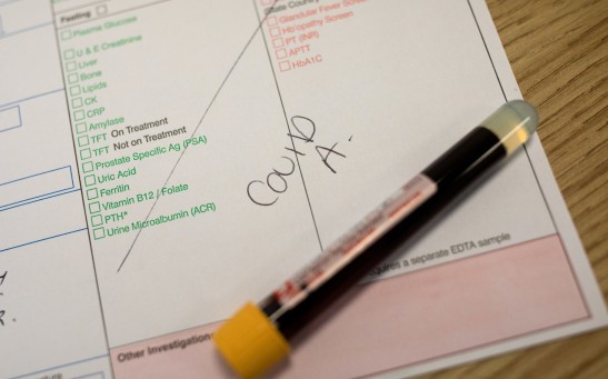 coronavirus antibody test 