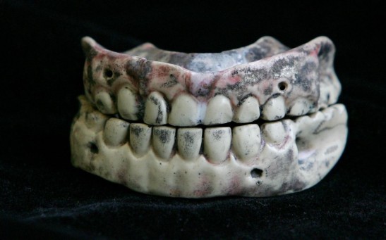 200 Year Old Dentures Displayed For World Smile Day