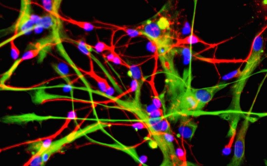 Science Times - Stem Cells Open Doors To Greater Understanding Of Neurlogical Diseases