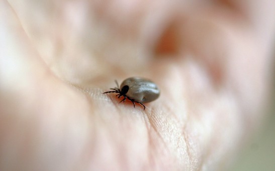 Science Times - Do You Expect Your Skin to be Toxic to Ticks, but It’s Not? Here’s Why, According to Science