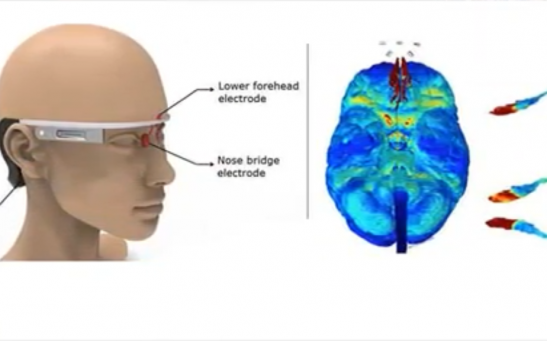 Scientists Invented A Wearable That Can Prevent Alzheimer's Disease