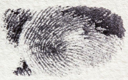 Sciences Times - 22-Year-Old Male Shares How Embarrassing It Is to Have no Fingerprints