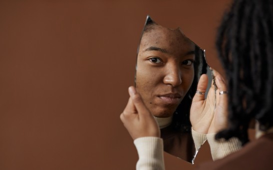 Science Times - People with Darker Skin, Likely to Suffer from Psychological Effects of Acne