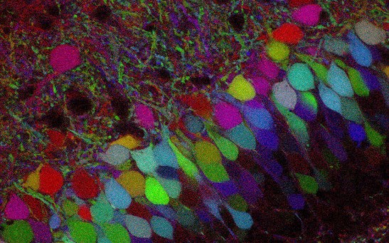 Image 2: neurons in the hippocampus