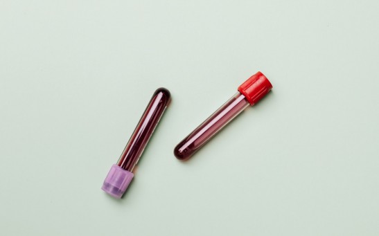 blood-samples-4047146/