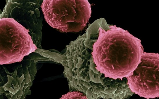  High Effectiveness of Immunotherapy Against Squamous Cell Carcinoma Leads to Better Outcomes