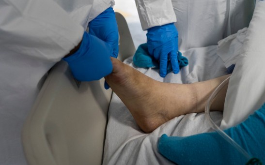 Patient's Foot 
