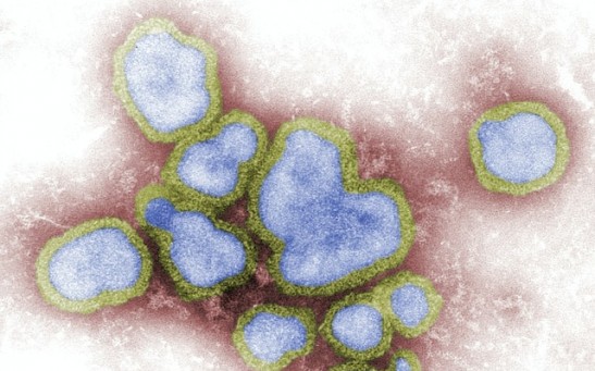 Science Times - 'Russian Flu' That Emerged in 1889, Possibly a Coronavirus; Scientists Found the Pandemic Seemed to Kill More Older Adults Than Children