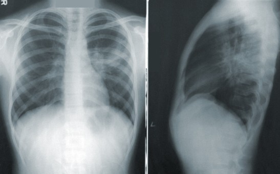  Explainable AI Accurately Labels X-Ray Images of Five Chest Pathologies Equivalent to Seven Human Experts