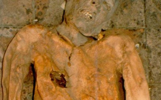 400-Year-Old Italian Mummy Provide Insights About the Mysterious Evolutionary History of E. Coli