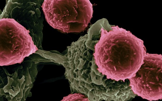  Cancer Treatment: Magnetic Nanoparticles Can Be Triggered to Release Anti-Cancer MicroRNA