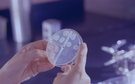 Mycobacterium tuberculosis drug susceptibility test.