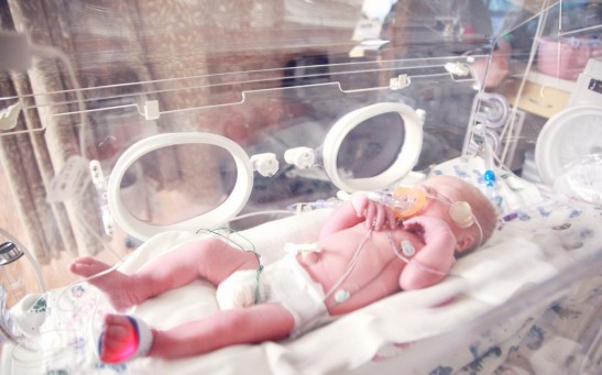 Baby lying in incubator