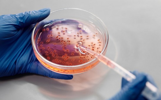 Bacterial colony quorum sensing