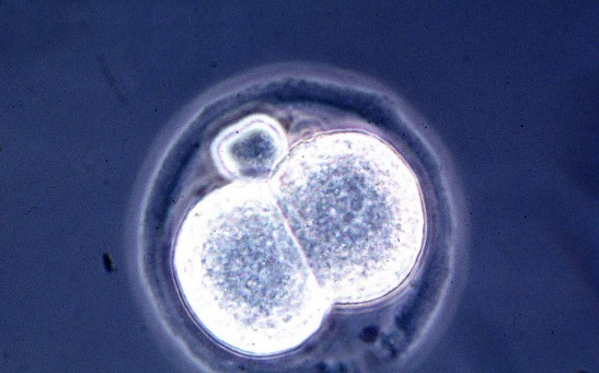 Microscopic View Of A Two Cell Mouse Embryo A Result Of A New And Relatively Simple Cloning Techniq