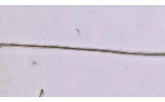 A hair growing from one of the cultured follicle organoids.