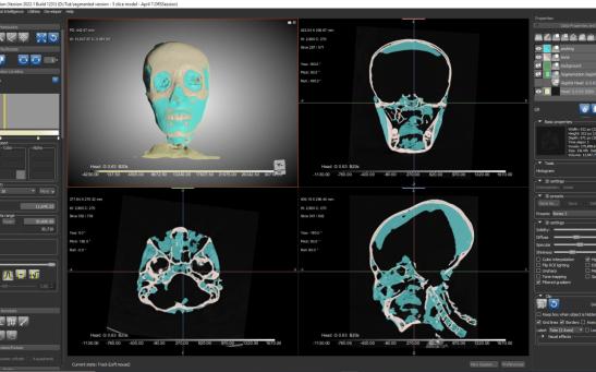 A screenshot of the computed tomography (CT) scans and 3D bioimaging software used to create a virtual model of King Tut’s skull.
