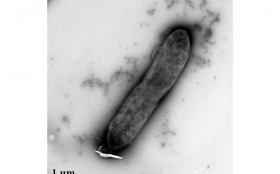 New research investigated whether silver nanoparticles could amplify the effects of antibiotics on antibiotic-resistant bacteria. 