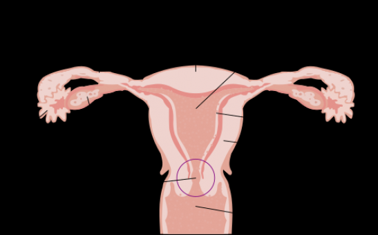 Ovarian Cancer Can Be Prevented By Fallopian Tube Removal [Study]