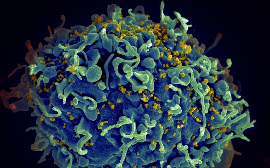 53-year-old HIV Patient Becomes Fifth in the World To Be Cured of AIDS-causing Virus