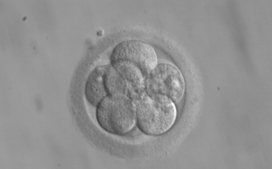 Ex Vivo Experiment on Monkey Embryos Reveal Their Fetal Development in 3D