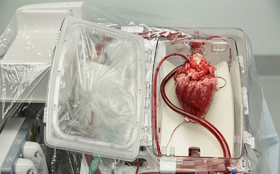 How Much Does a Heart Cost? Exploring the Worth, Procedure and Success Rate of Heart Transplant Surgery