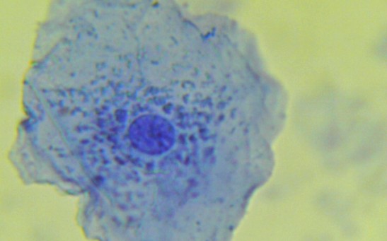 Cellular Compartment Exclusome Identified as the New Mammalian Organelle Made of DNA Rings