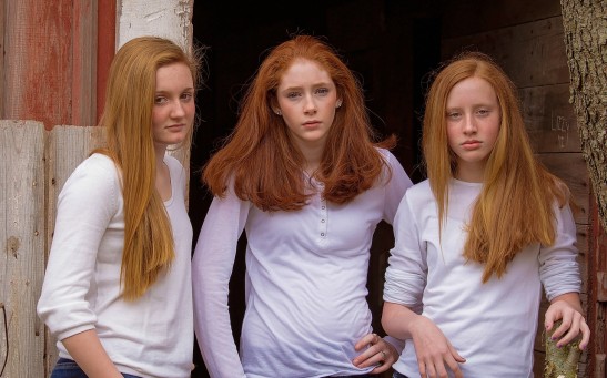Do Redheads Experience Pain Differently? The Influence of Hair Color on Anesthesia Prescriptions