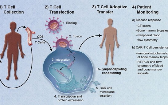 CAR-T Cell Therapy May Cause Cancer, FDA Warns
