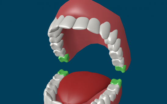 Why Do Humans Have Wisdom Teeth? Exploring the Evolutionary History of the Third Molars