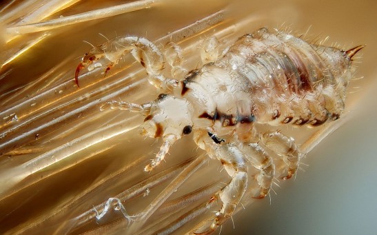 Why Do Lice Cause Itching? A Closer Look into the Mechanisms Behind The Itchy Bites by These Tiny Parasites