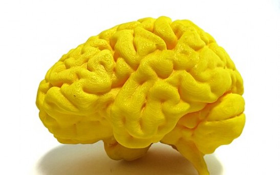 World’s First High-Resolution 3D-Printed Brain Developed as Model for Investigating Neurodegenerative Diseases