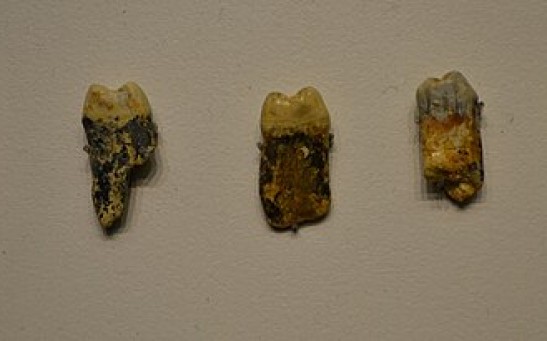 4,000-Year-Old Teeth Reveal Microbiome From Bronze Age; What Does Bacterial Genome Say About Evolution of Human Diet?
