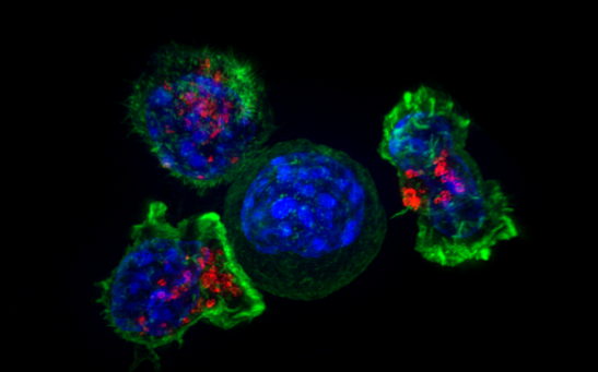 Cancer Cells Create Acidic Barrier To Evade Immune System