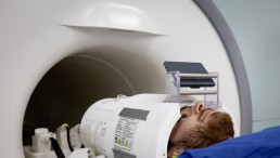  AI-Enhanced MRI Could Better Detect Brain Abnormalities