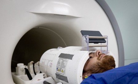  AI-Enhanced MRI Could Better Detect Brain Abnormalities