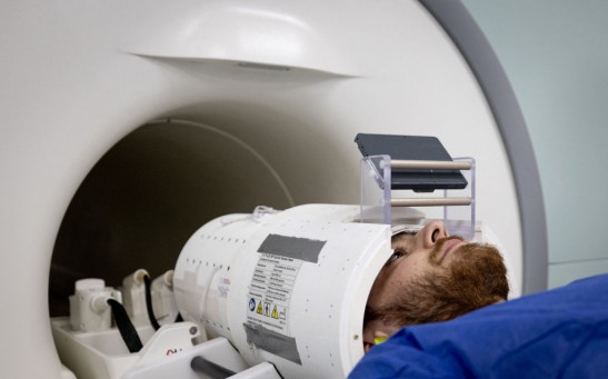  AI-Enhanced MRI Could Better Detect Brain Abnormalities